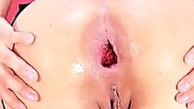 Designing Anal Fist Teen Ruined Asshole Anal Gape Loose assholee