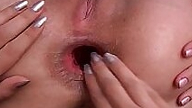 Gaping Bore Teen Anal Fisted By Lesbian Girlfriend