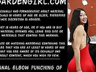 Double anal elbow fisting and punching of Dirtygardengirl  Hotkinkyjo