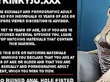 Hotkinkyjo ruined anal hole fisted by AlexThorn until colour up rinse prolapse